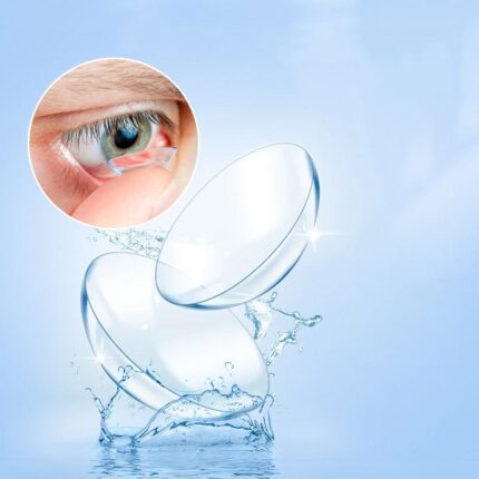 transparent contact lens